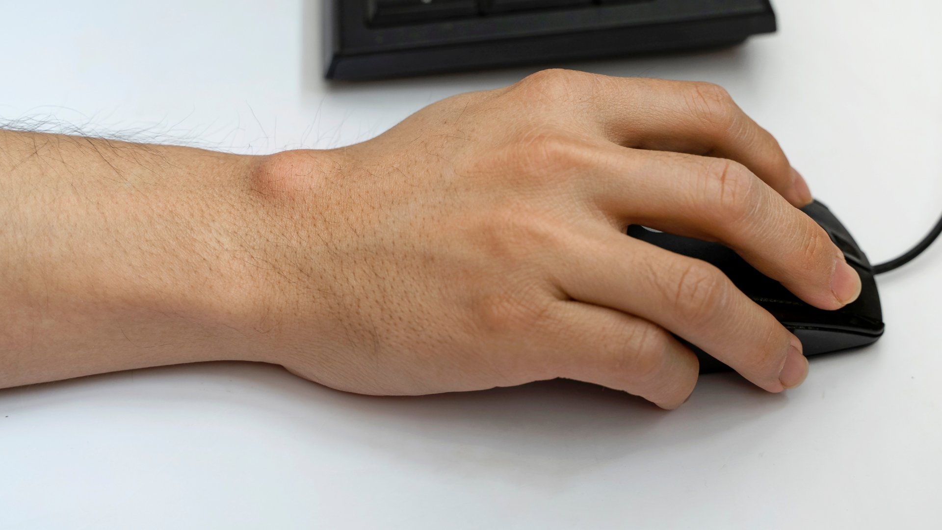 ganglion cyst diagnosis boise